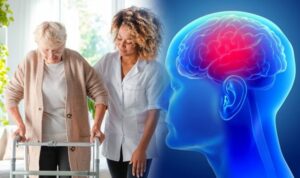 CBD For People With Parkinson’s Disease